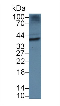 Torsin 1B (TOR1B) Human Polyclonal Antibody