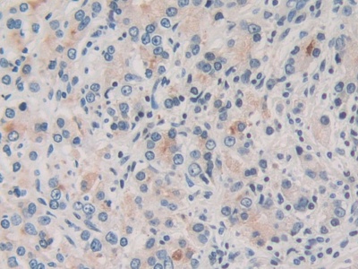 Torsin 1A (TOR1A) Human Polyclonal Antibody