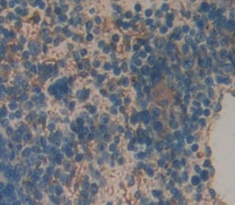 Visinin Like Protein 1 (VSNL1) Mouse Polyclonal Antibody