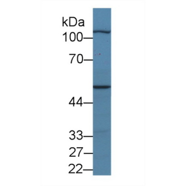 Myopalladin (MYPN) Human Polyclonal Antibody