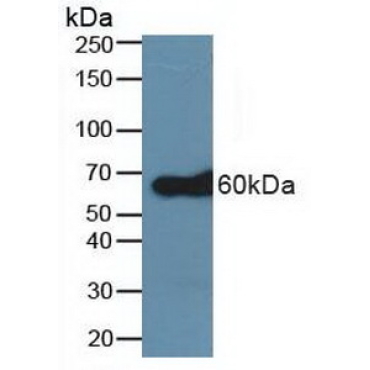 TNF Receptor Associated Factor 6 (TRAF6) Human Polyclonal Antibody