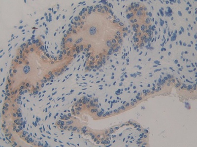 TNF Receptor Associated Factor 2 (TRAF2) Mouse Polyclonal Antibody