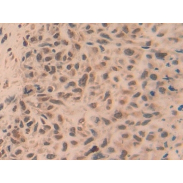 TNF Receptor Associated Factor 5 (TRAF5) Human Polyclonal Antibody