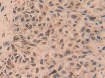 TNF Receptor Associated Factor 5 (TRAF5) Human Polyclonal Antibody