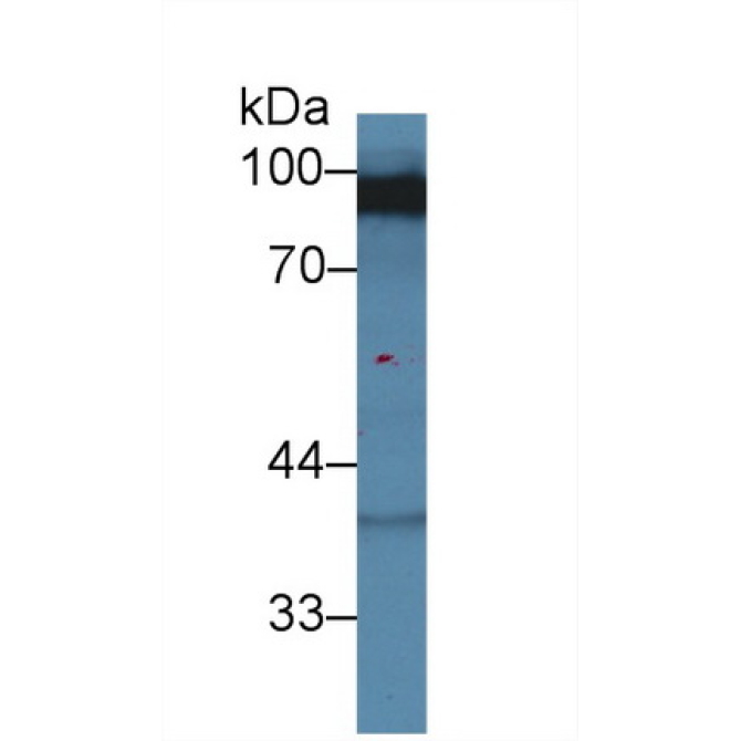 Discs, Large Homolog 3 (DLG3) Human Polyclonal Antibody