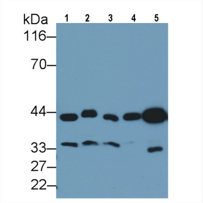 Crk Like Protein (CRKL) Human Polyclonal Antibody