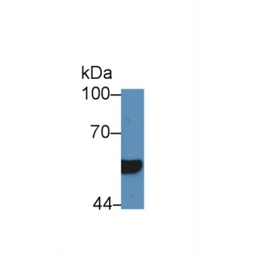 Hepatocyte Nuclear Factor 1 Beta (HNF1b) Human Polyclonal Antibody