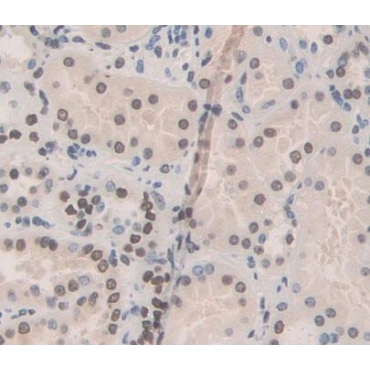Transcription Termination Factor, RNA polymerase I (TTF1) Human Polyclonal Antibody
