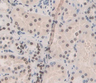 Transcription Termination Factor, RNA polymerase I (TTF1) Human Polyclonal Antibody