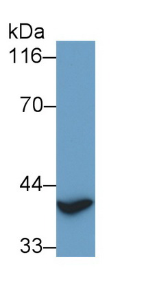Thyroid Transcription Factor 1 (TITF1) Human Polyclonal Antibody
