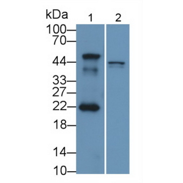 Mdm2 p53 Binding Protein Homolog (MDM2) Human Polyclonal Antibody