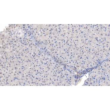 Translocation Associated Notch Homolog 1 (TAN1) Human Polyclonal Antibody