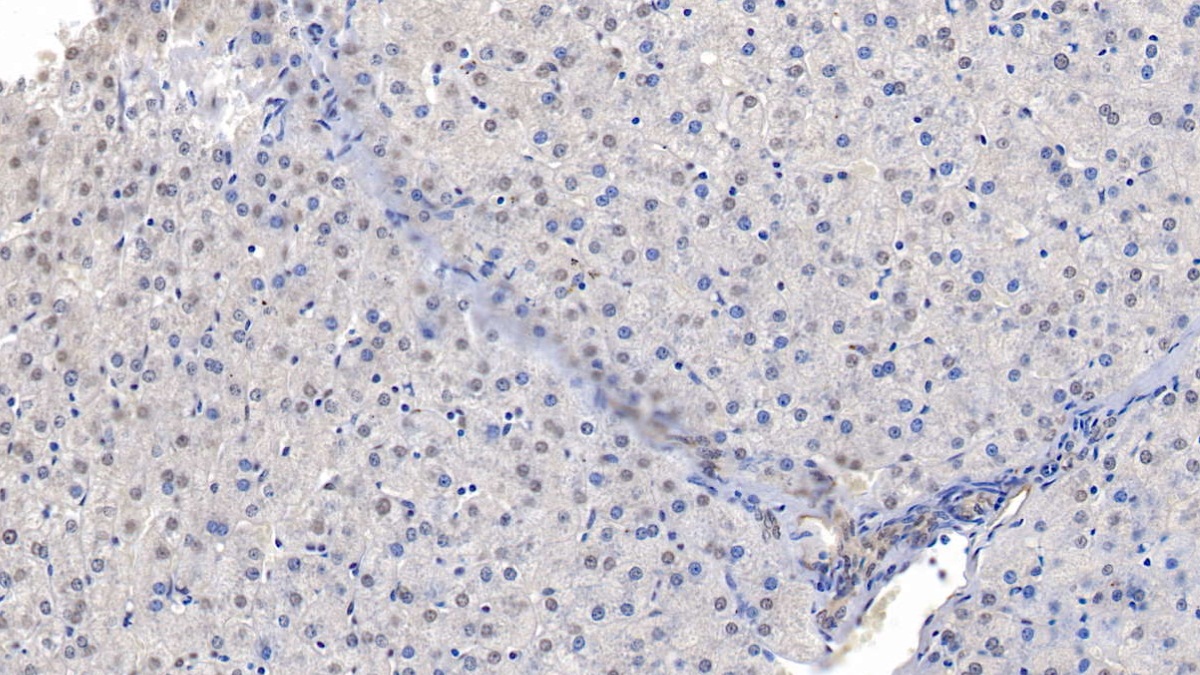 Translocation Associated Notch Homolog 1 (TAN1) Human Polyclonal Antibody