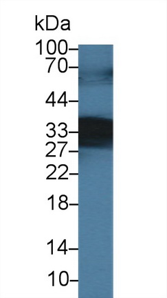 Secretagogin (SCGN) Rat Polyclonal Antibody