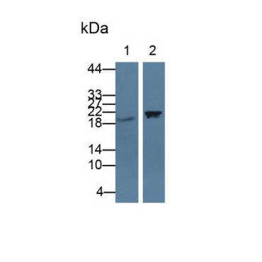 Cold Inducible RNA Binding Protein (CIRBP) Human Polyclonal Antibody