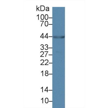 Ankyrin Repeat Domain Protein 1 (ANKRD1) Human Polyclonal Antibody
