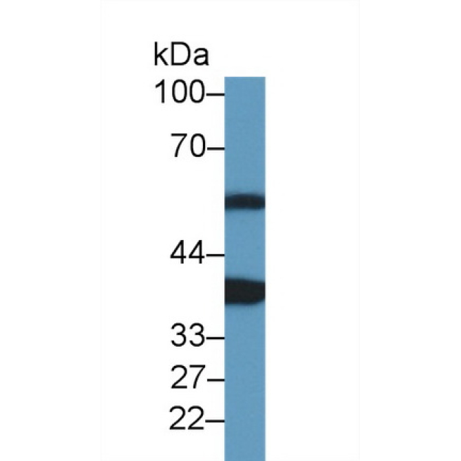 Ankyrin Repeat Domain Protein 1 (ANKRD1) Mouse Polyclonal Antibody