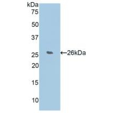 WNT1 Inducible Signaling Pathway Protein 2 (WISP2) Human Polyclonal Antibody