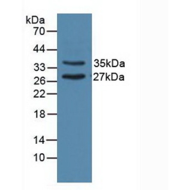 Uracil DNA Glycosylase (UNG) Human Polyclonal Antibody