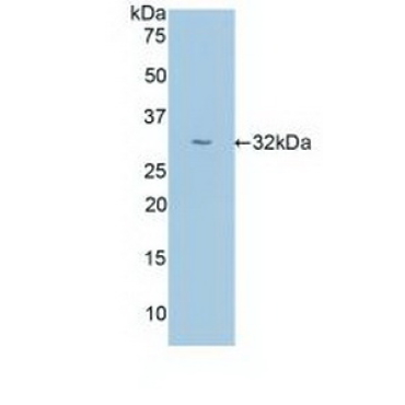 Uromodulin (UMOD) Human Polyclonal Antibody