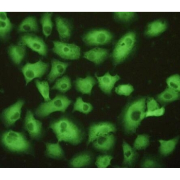 Ubiquitin Carboxyl Terminal Hydrolase L1 (UCHL1) Human Polyclonal Antibody