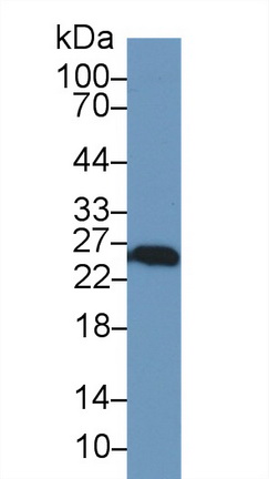 Ubiquitin Carboxyl Terminal Hydrolase L1 (UCHL1) Rat Polyclonal Antibody