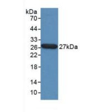 Tumor Protein, Translationally Controlled 1 (TPT1) Human Polyclonal Antibody