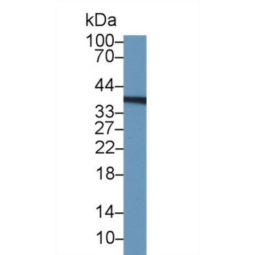 Thymidylate Synthetase (TYMS) Human Polyclonal Antibody