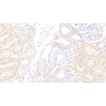 Interferon Alpha 21 (IFNa21) Human Polyclonal Antibody