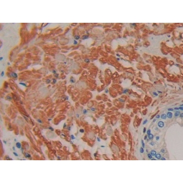 Interferon Alpha 7 (IFNa7) Human Polyclonal Antibody