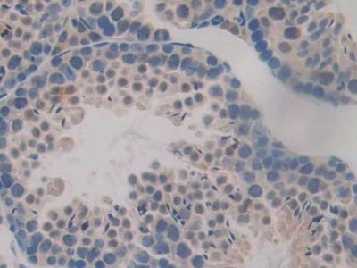 TTK Protein Kinase (TTK) Mouse Polyclonal Antibody