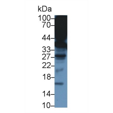 Alpha-Tocopherol Transfer Protein (TTPa) Mouse Polyclonal Antibody