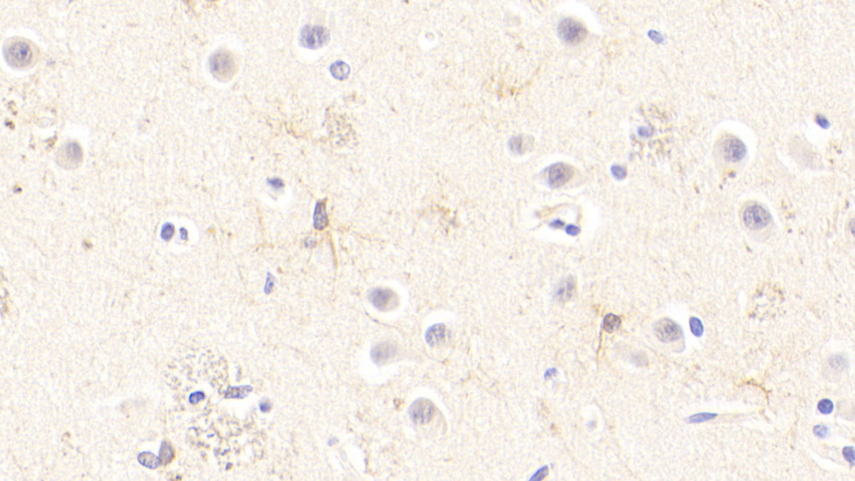 Transformation/Transcription Domain Associated Protein (TRRAP) Human Polyclonal Antibody