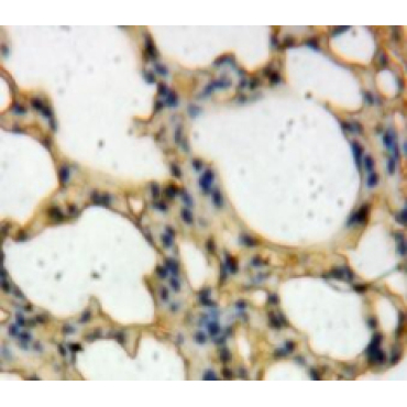 Toll Like Receptor Adaptor Molecule 2 (TICAM2) Human Polyclonal Antibody