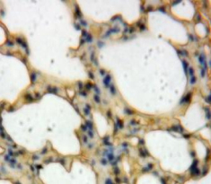 Toll Like Receptor Adaptor Molecule 2 (TICAM2) Human Polyclonal Antibody