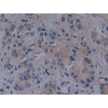 Toll Like Receptor Adaptor Molecule 1 (TICAM1) Human Polyclonal Antibody