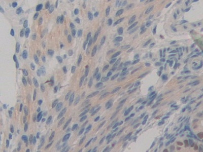 Toll Like Receptor Adaptor Molecule 1 (TICAM1) Mouse Polyclonal Antibody