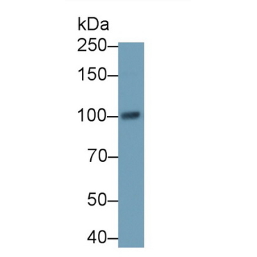 TANK Binding Kinase 1 (TBK1) Human Polyclonal Antibody