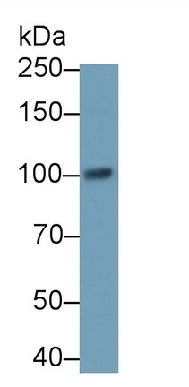 TANK Binding Kinase 1 (TBK1) Human Polyclonal Antibody