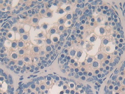 STAM Binding Protein (STAMBP) Mouse Polyclonal Antibody