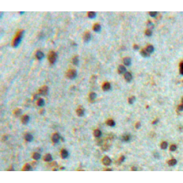 SRSF Protein Kinase 2 (SRPK2) Human Polyclonal Antibody