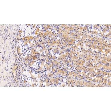Sorcin (SRI) Human Polyclonal Antibody
