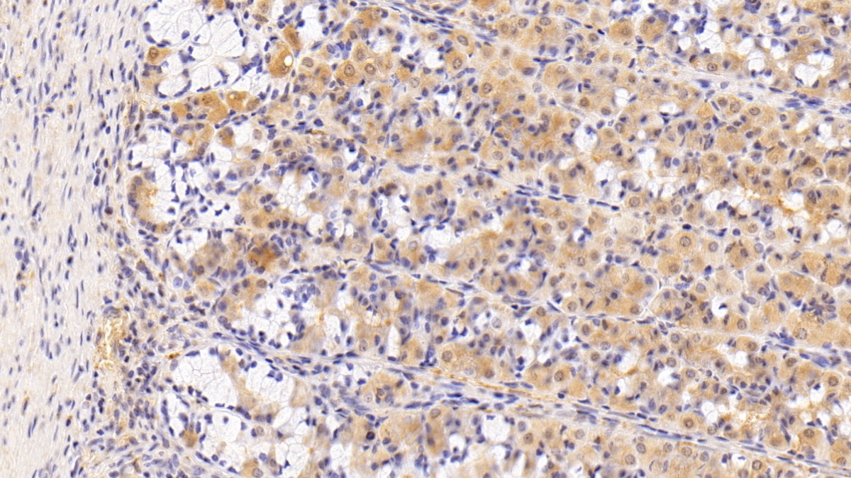 Sorcin (SRI) Human Polyclonal Antibody