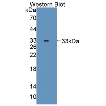 Serine Palmitoyltransferase, Long Chain Base Subunit 3 (SPTLC3) Human Polyclonal Antibody