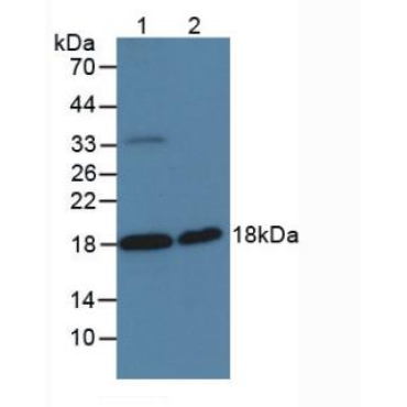 Serine Peptidase Inhibitor Kunitz Type 2 (SPINT2) Human Polyclonal Antibody