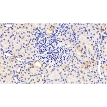 Serine Peptidase Inhibitor Kazal Type 5 (SPINK5) Human Polyclonal Antibody