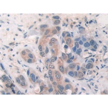 Suppressors Of Cytokine Signaling 2 (SOCS2) Human Polyclonal Antibody
