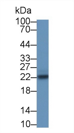 Suppressors Of Cytokine Signaling 2 (SOCS2) Rat Polyclonal Antibody