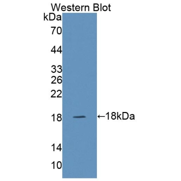 SNAP Associated Protein (SNAPAP) Human Polyclonal Antibody