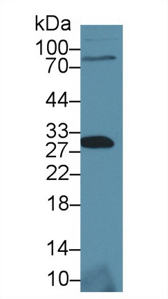 Signaling Threshold Regulating Transmembrane Adaptor 1 (SIT1) Rat Polyclonal Antibody